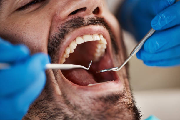 Dental Bonding in Bessemer City, NC